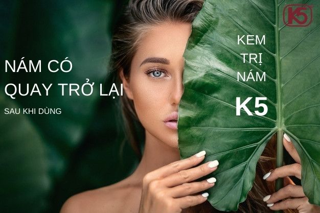 NÁM CÓ QUAY TRỞ LẠI SAU KHI DÙNG KEM TRỊ NÁM K5?