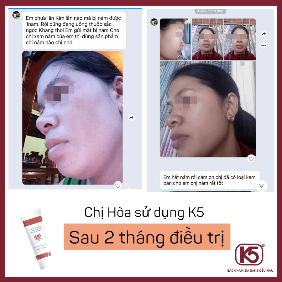 Ước Mơ Sạch Nám Của Tôi Cuối Cùng Đã TRở Thành Hiện Thực