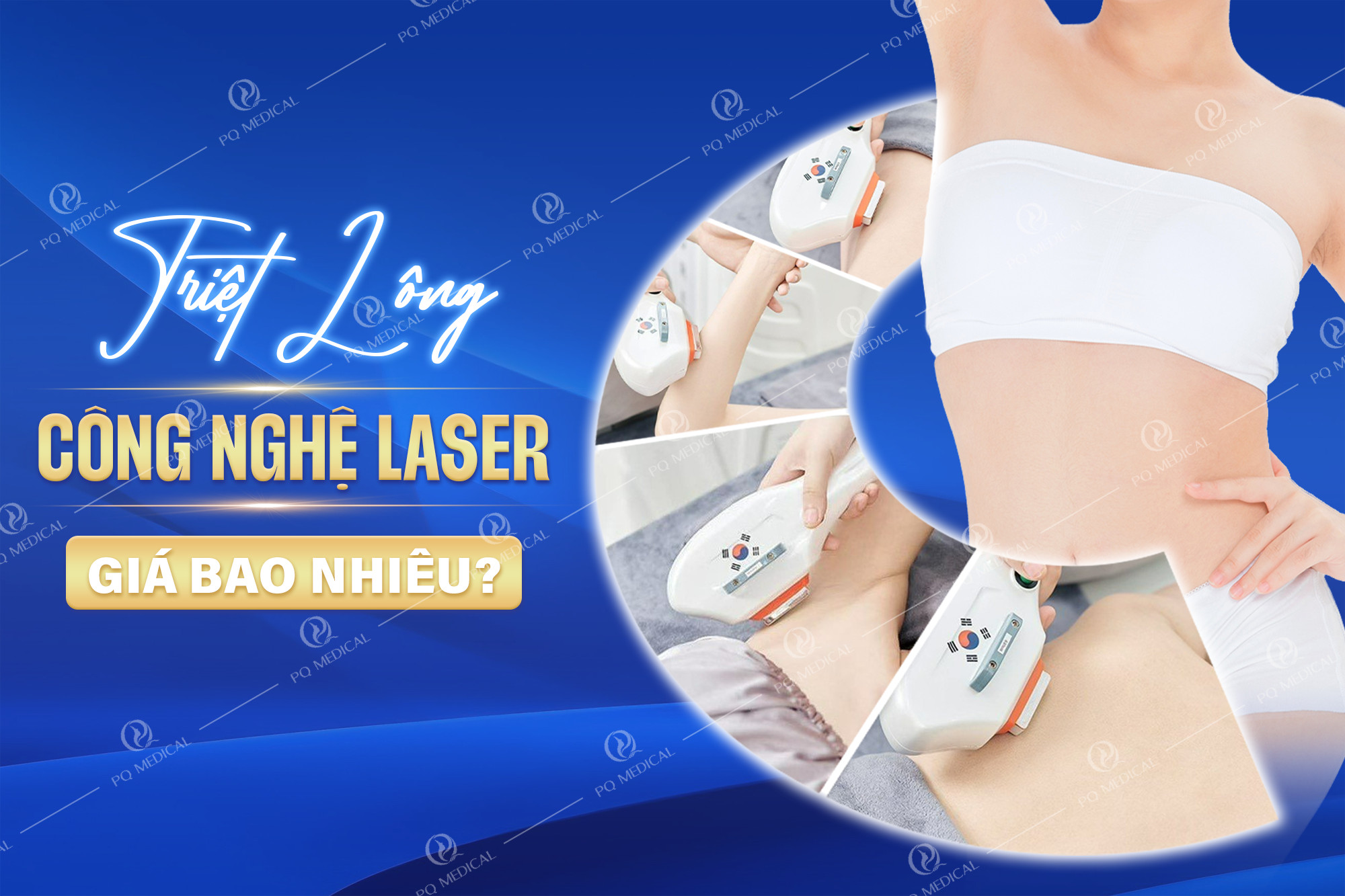 Triệt lông bằng công nghệ laser giá bao nhiêu?