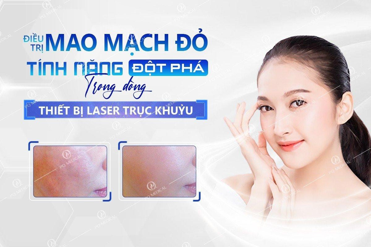 Điều trị mao mạch đỏ - Bước đột phá mới ở dòng thiết bị Laser trục khuỷu mới nhất PQ Medical