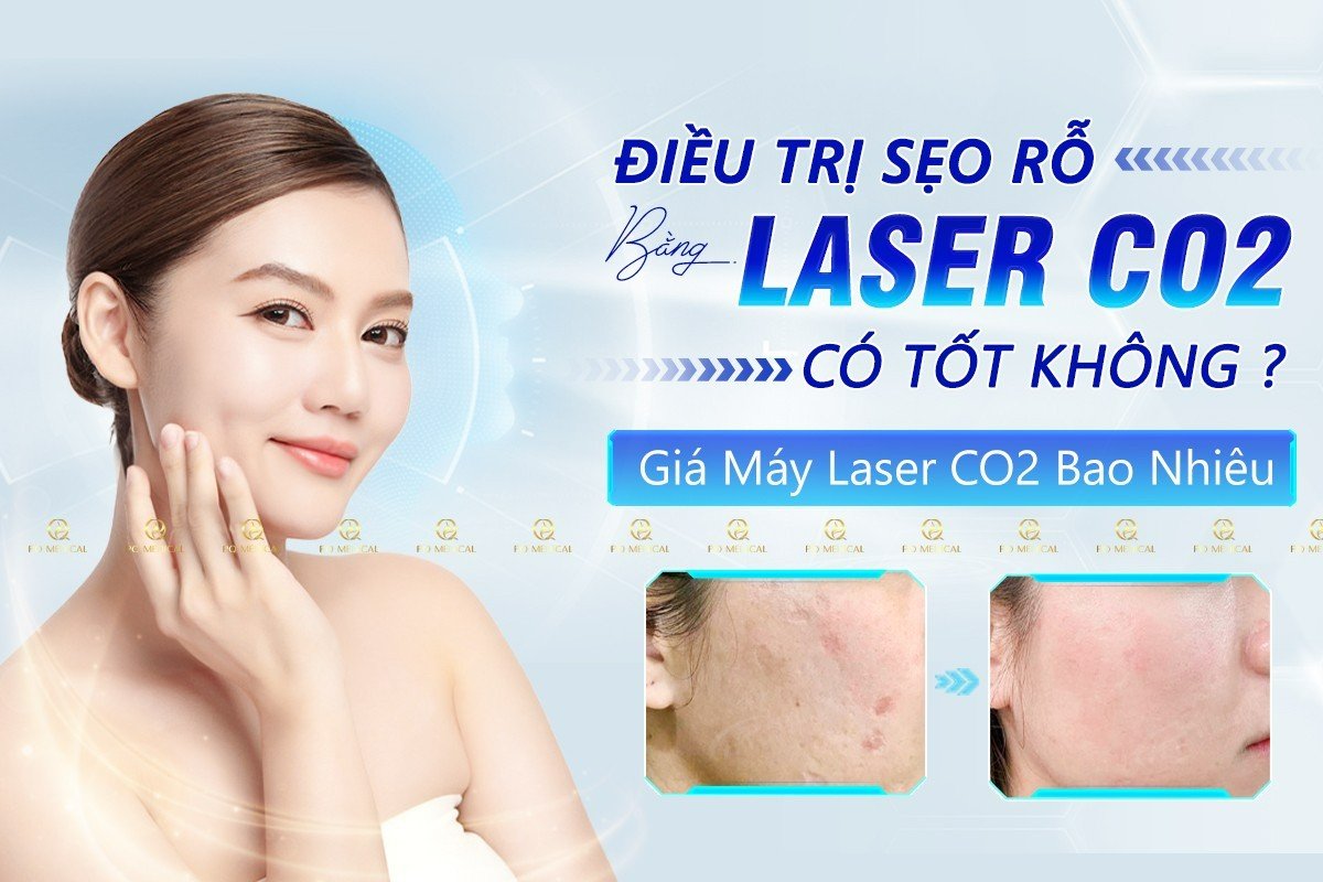 Trị Sẹo Rỗ Bằng Laser CO2 Có Tốt Không? Giá Máy Laser CO2 Bao Nhiêu?