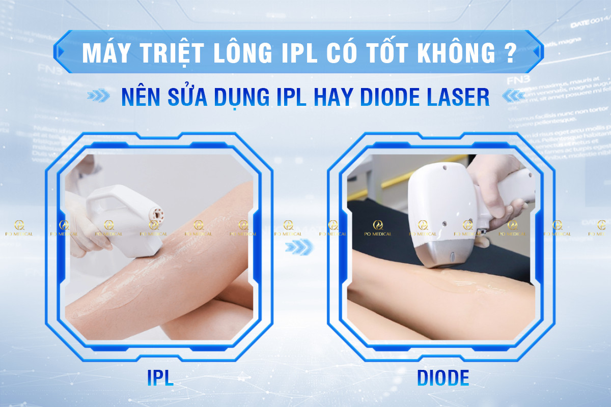 Máy Triệt Lông IPL Có Tốt Không? Nên Sử Dụng IPL Hay Diode Laser