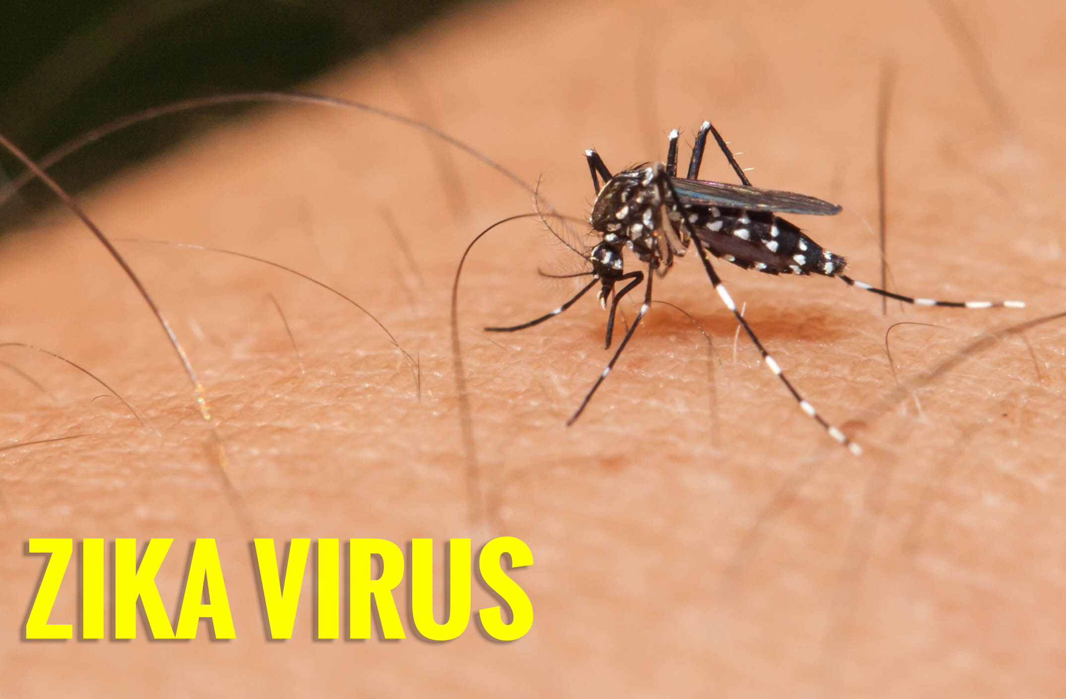 VIRUS ZIKA: CÁC BÁC SĨ NHI KHOA CẦN CHUẨN BỊ CHO MỘT “BÌNH THƯỜNG MỚI”