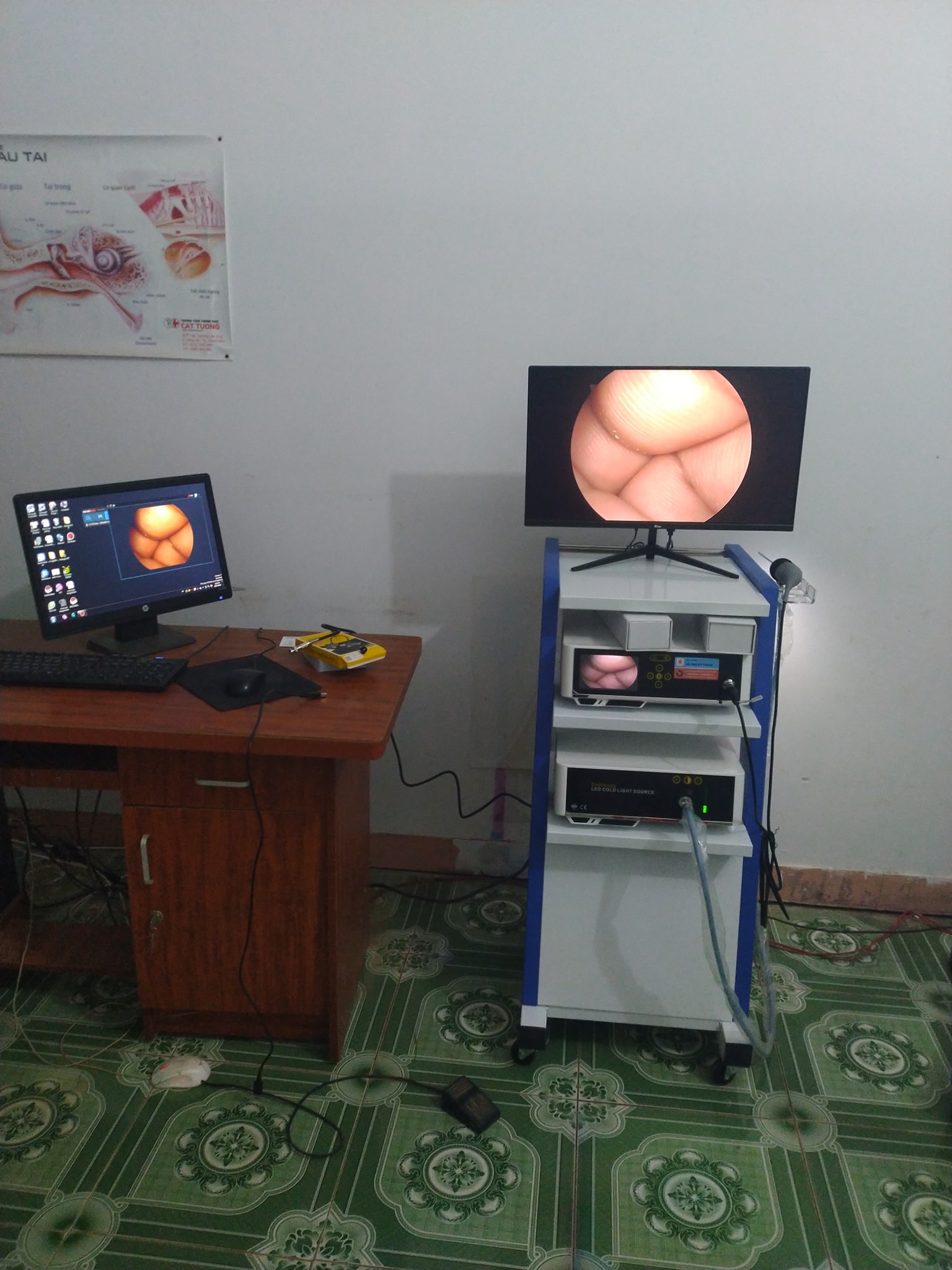 Duy Cường - Lắp đặt và bàn giao máy nội soi tai mũi họng Yikeda HD YKD-9007