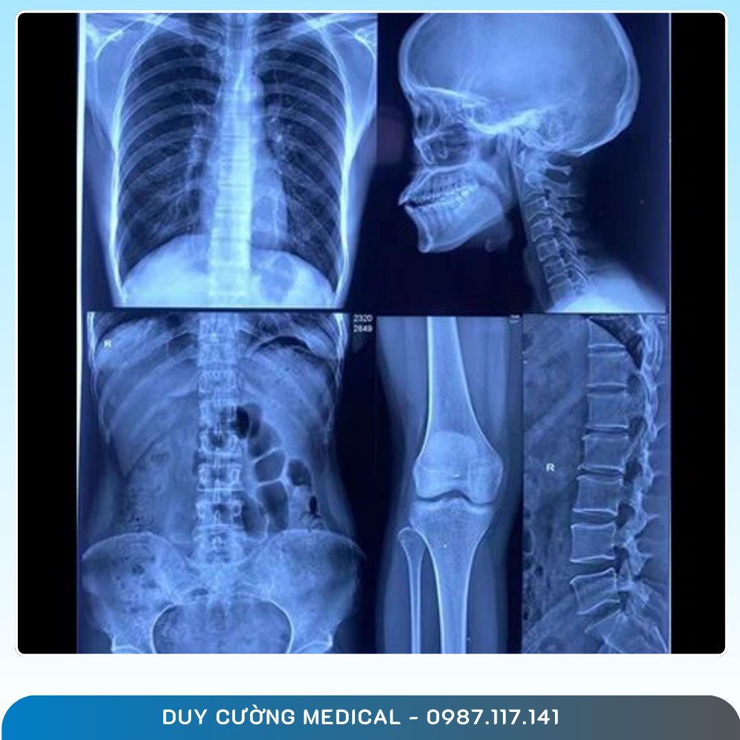 FILM X-QUANG LASER NANYANG – GIẢI PHÁP IN ẢNH CHẨN ĐOÁN CHÍNH XÁC, TIẾT KIỆM CHI PHÍ