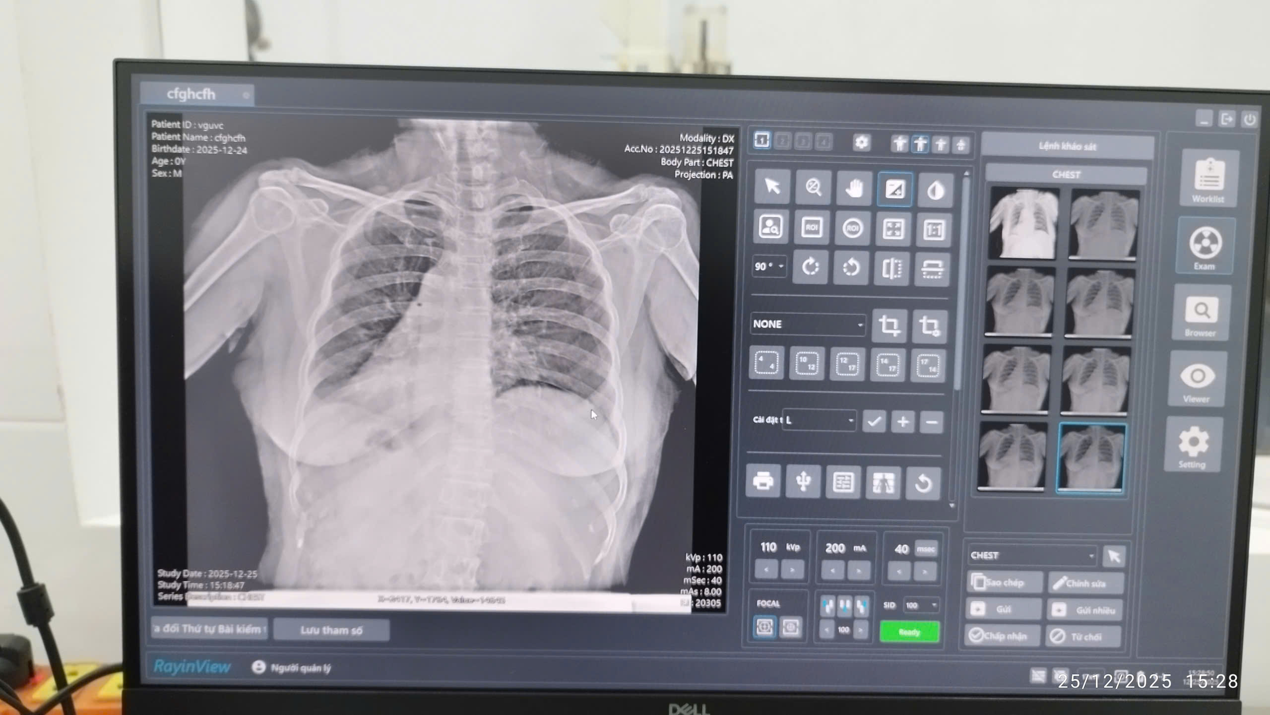 FILM X-QUANG LASER NANYANG – GIẢI PHÁP IN ẢNH CHẨN ĐOÁN CHÍNH XÁC, TIẾT KIỆM CHI PHÍ