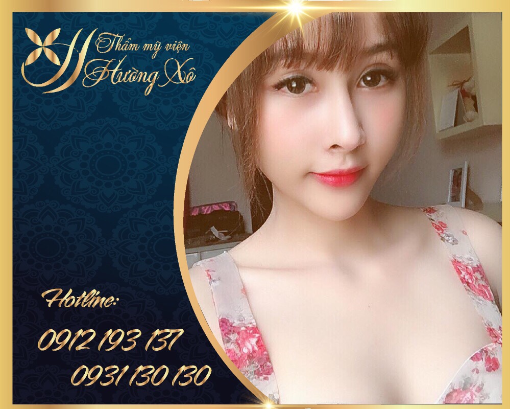 Nâng mũi bọc sụn tại Vinh - Nghệ An | Thẩm mỹ viện Hường Xô