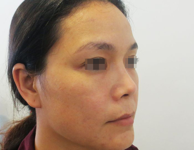 thẩm mỹ hường xô