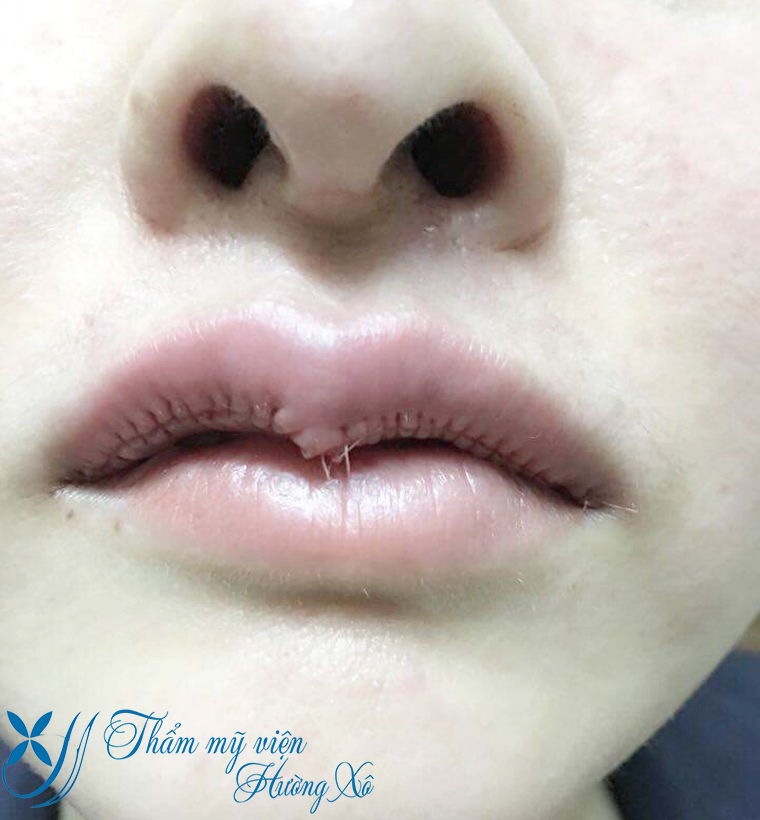 Thẩm mỹ viện Hường Xô