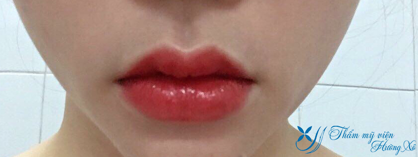 Thẩm mỹ viện Hường Xô