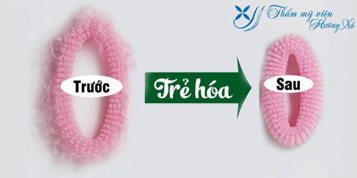 Thẩm mỹ viện Hường Xô