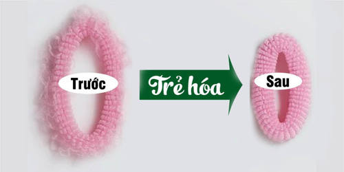 Trẻ hóa âm đạo tại Vinh - nghệ an