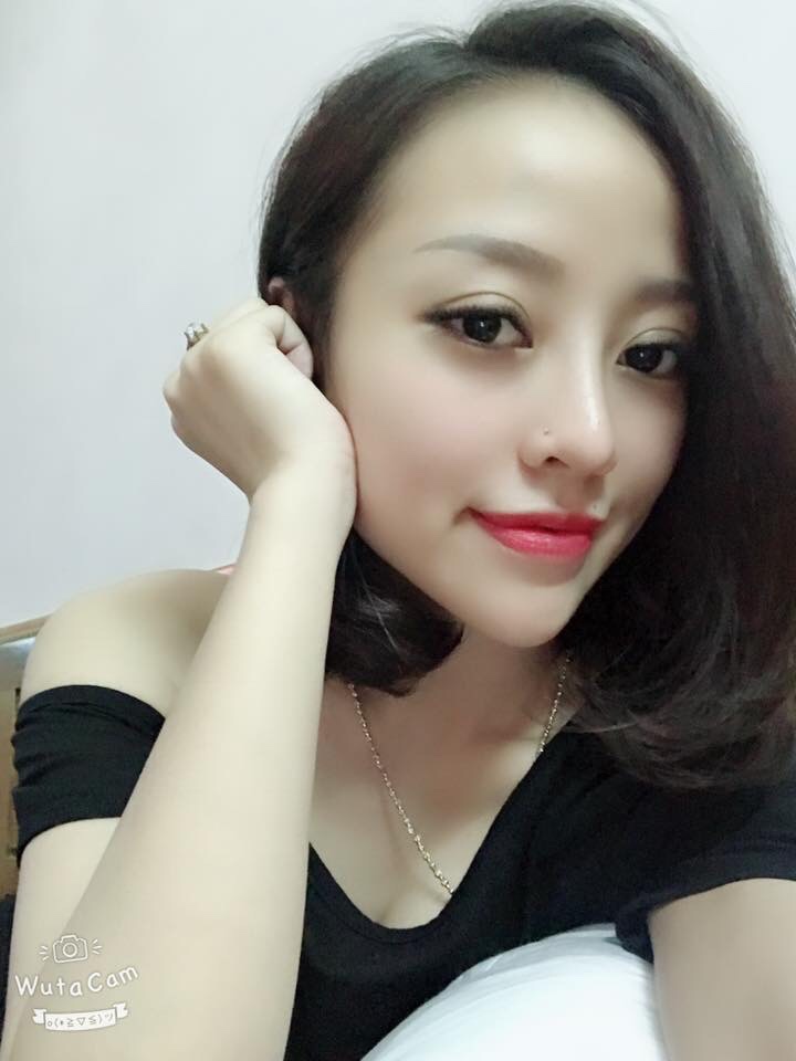 phảu thuật độn cằm tại Vinh, nghệ An