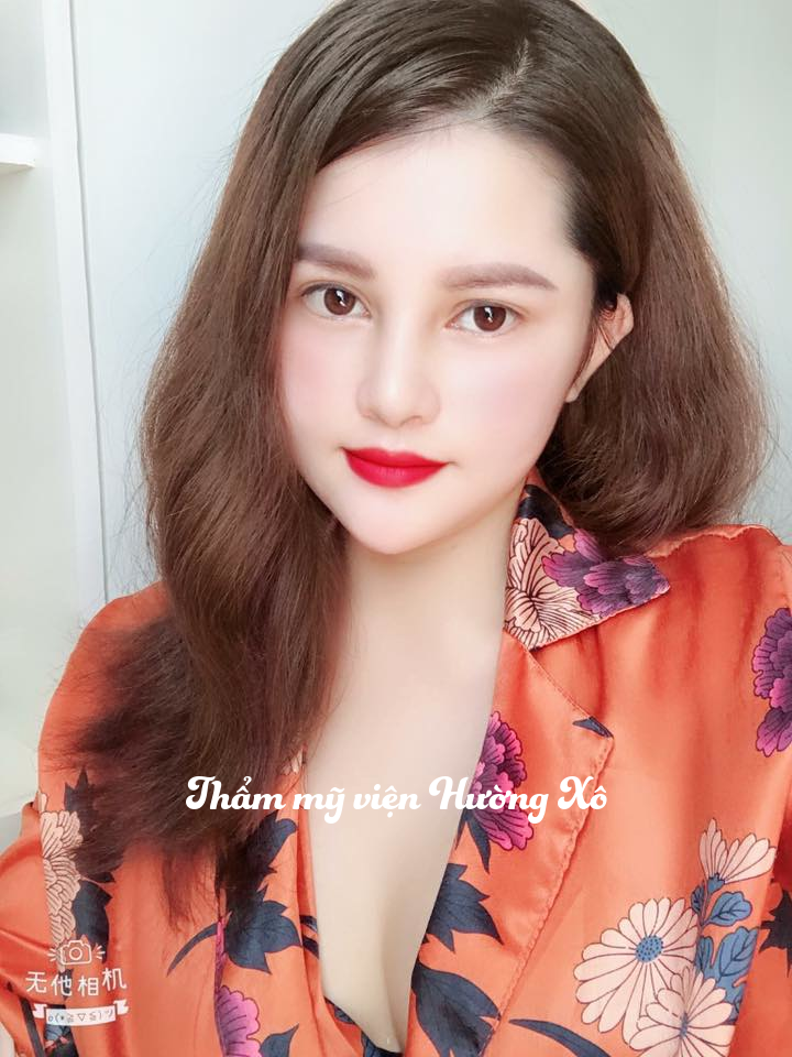 Phẩu thuật độn Thái Dương