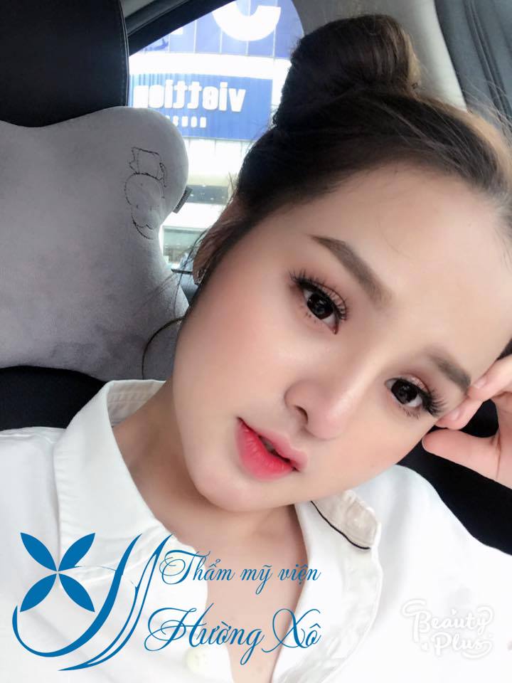 Nâng cơ hifu tại Vinh Nghệ An