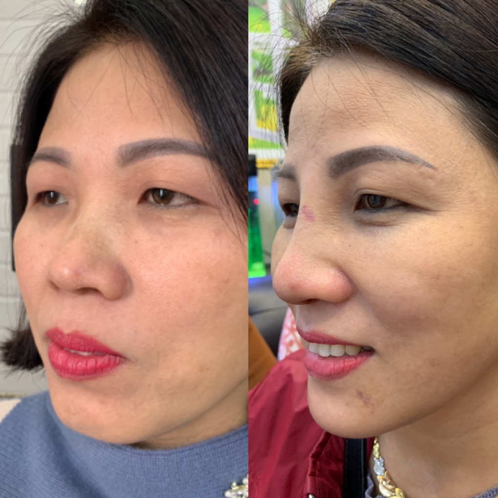 phẫu thuật thẩm mỹ