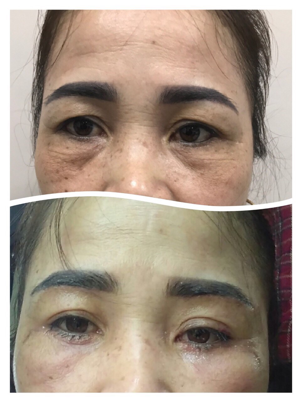 phẫu thuật thẩm mỹ