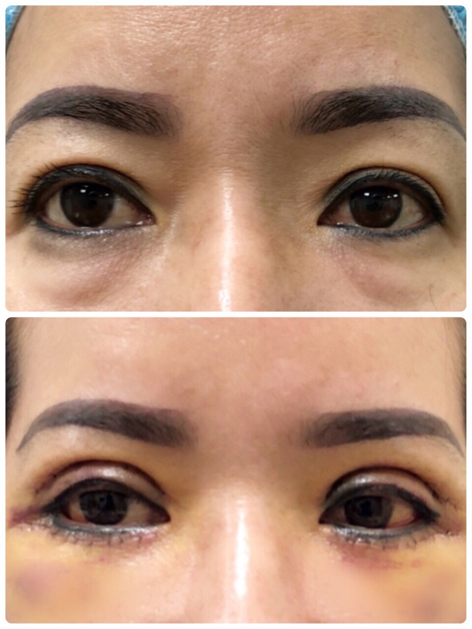 phẫu thuật thẩm mỹ