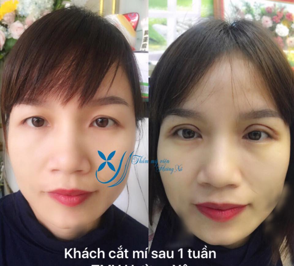 thẩm mỹ uy tín tại vinh