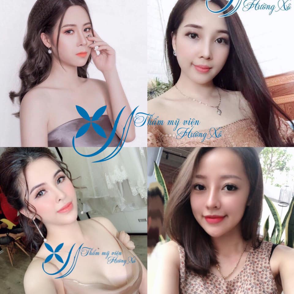 thẩm mỹ uy tín tại vinh