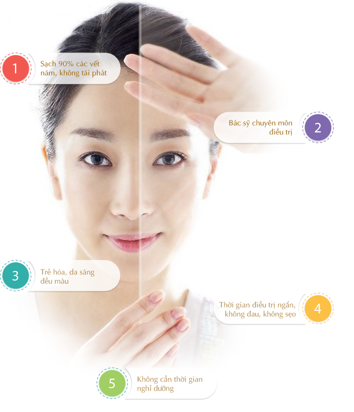 điều trị nám tại nghệ an