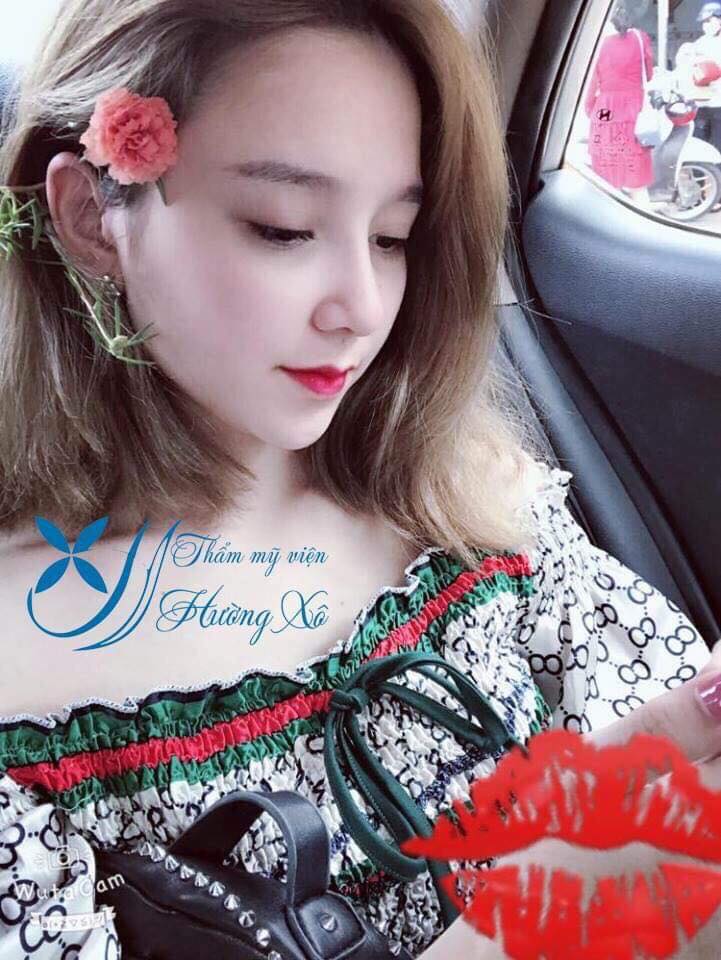 phẫu thuật nâng mũi tại nghệ an