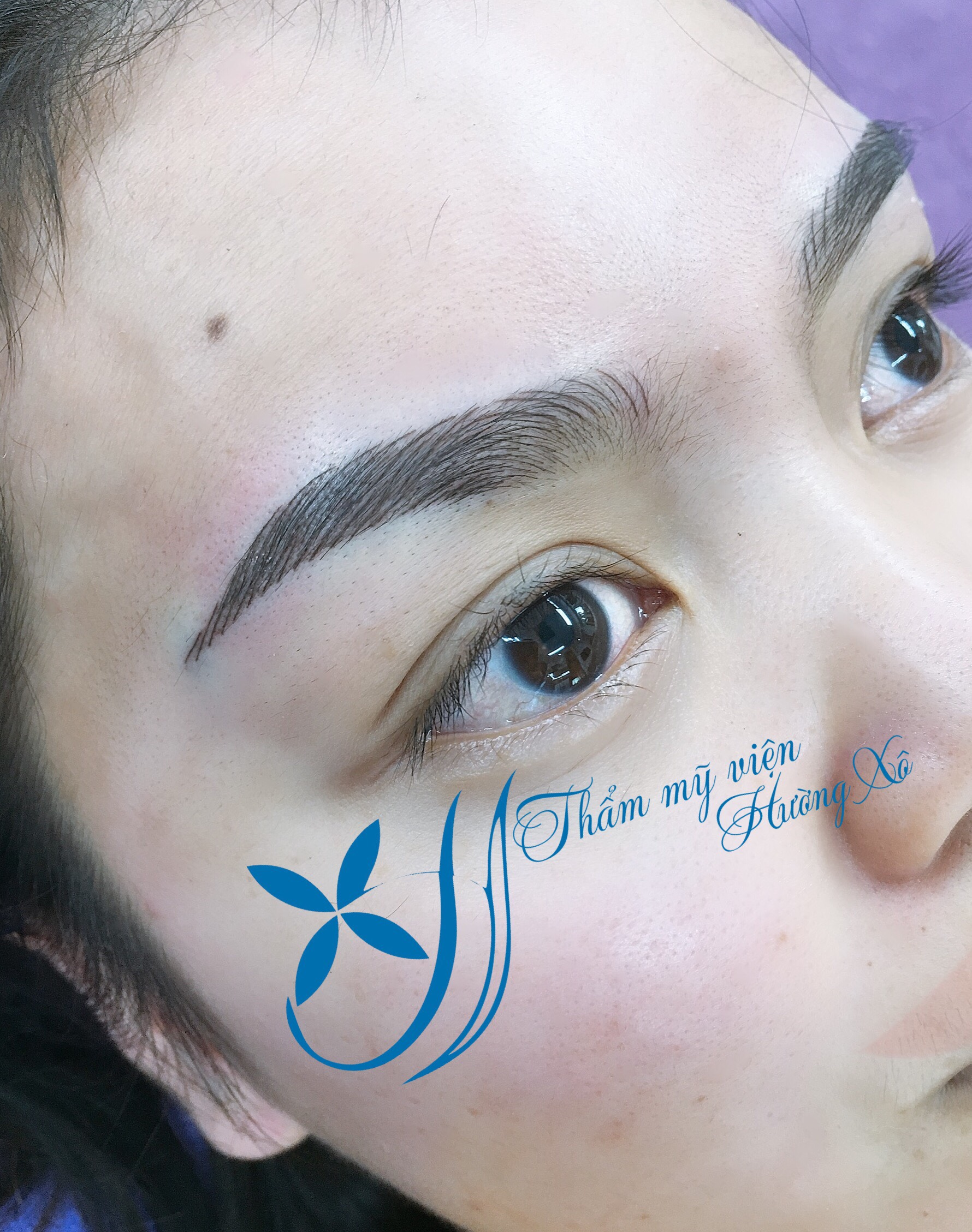 ĐIÊU KHÁC LÔNG MÀY 