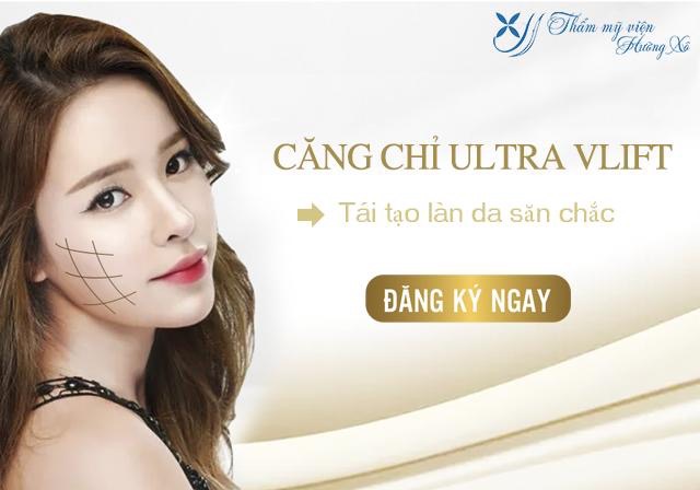 Căng da mặt bằng chỉ Ultra V-lift tại Vinh
