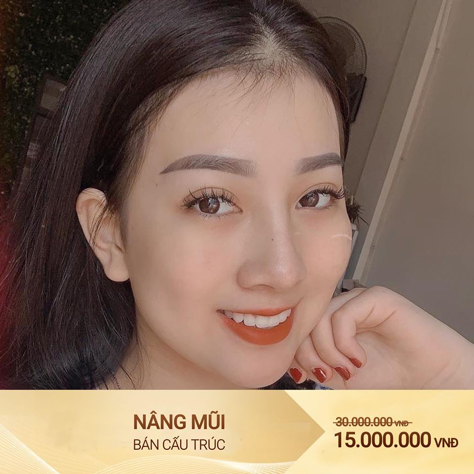 nâng mũi tại vinh