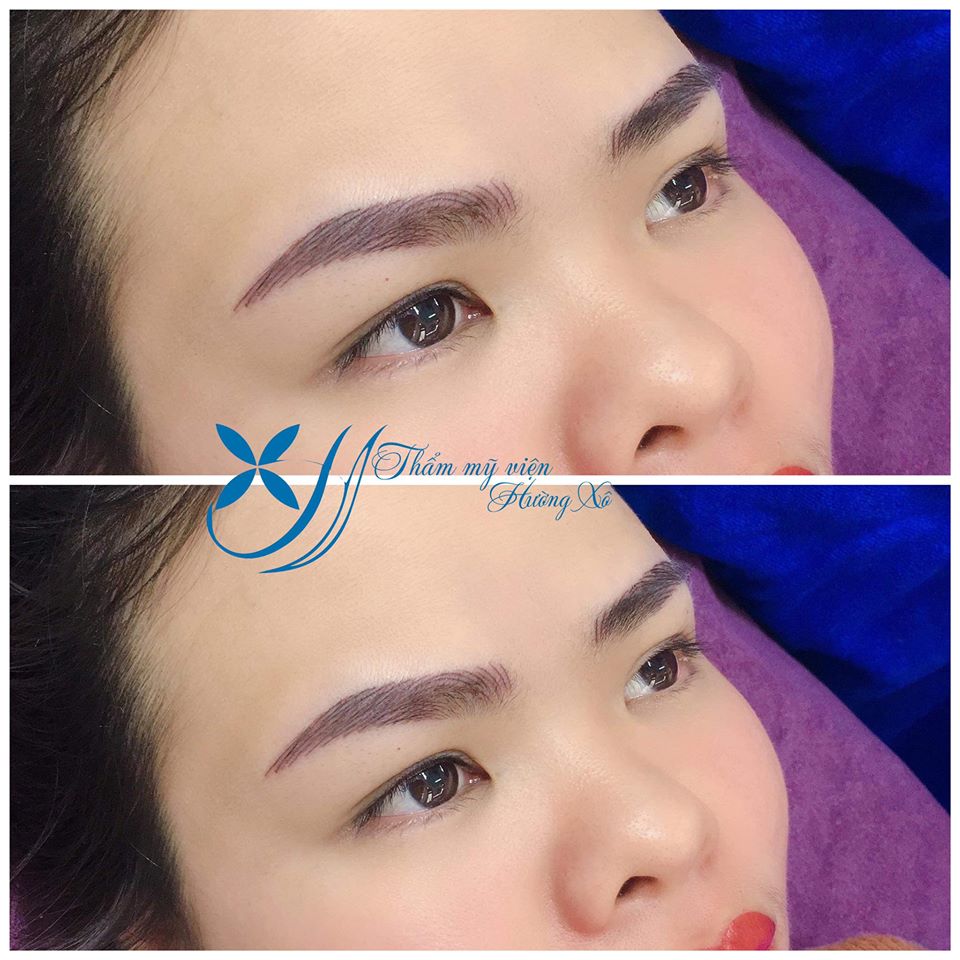 Khuyến mãi dịch vụ thẩm mỹ 8/3