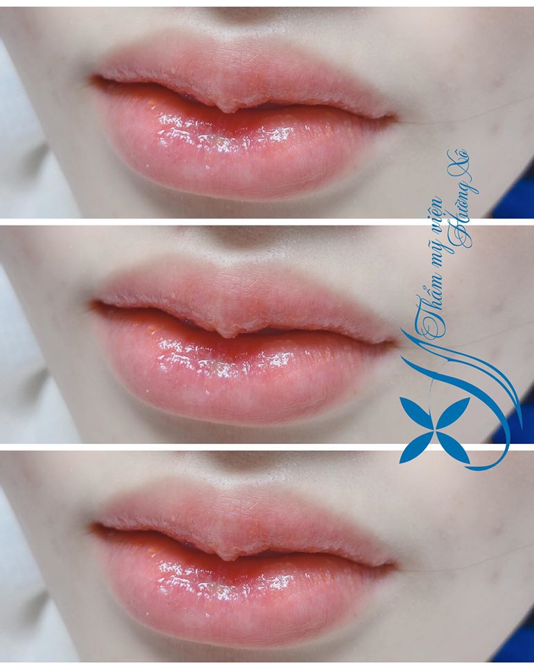 Khuyến mãi dịch vụ thẩm mỹ 8/3