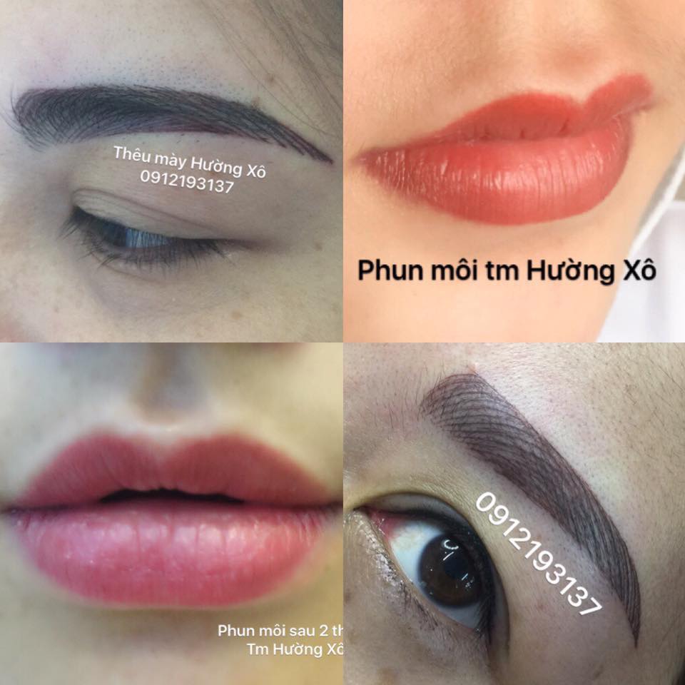 Phẫu thuật thẩm mỹ tại Hà Tĩnh