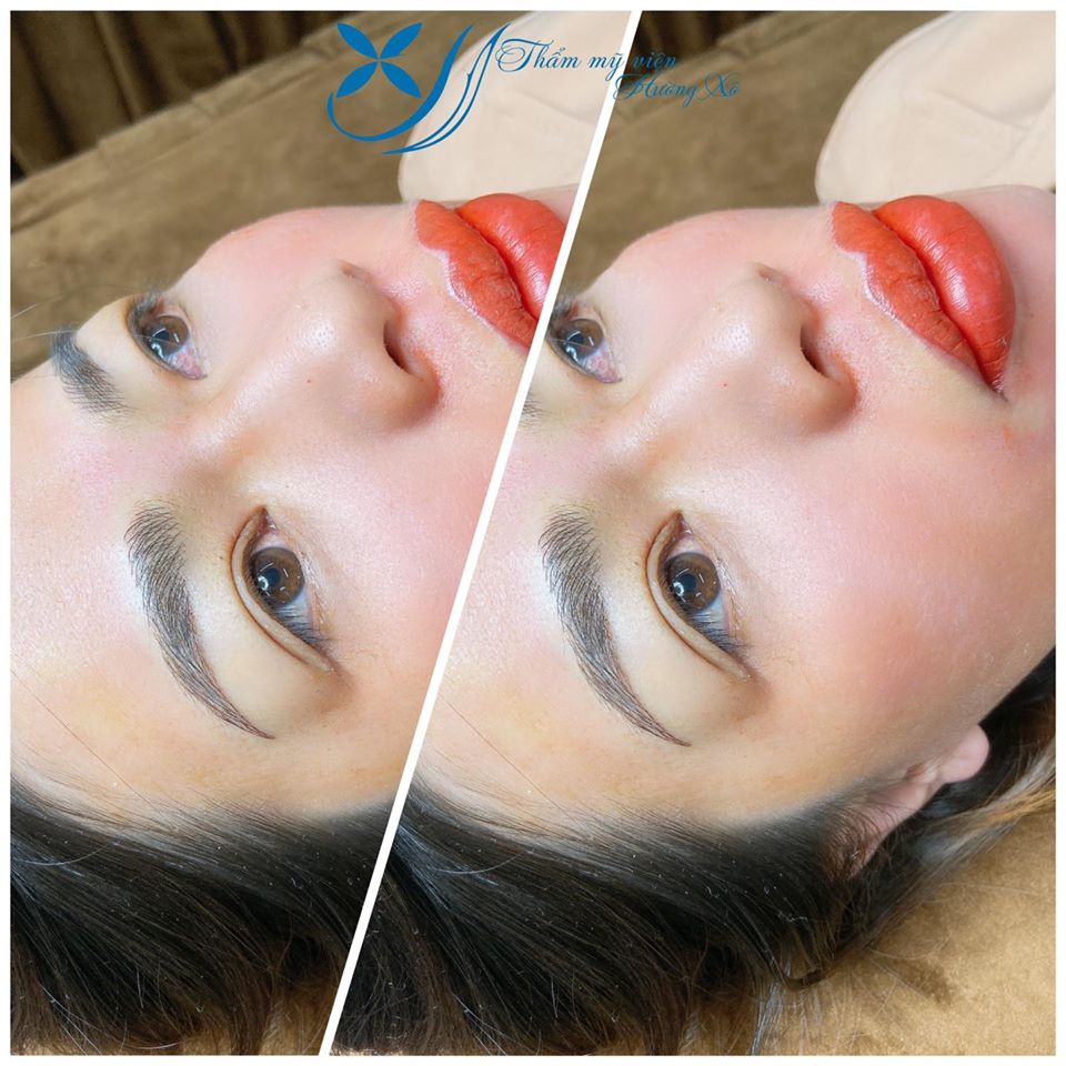 phun môi collagen tại Hà Tĩnh