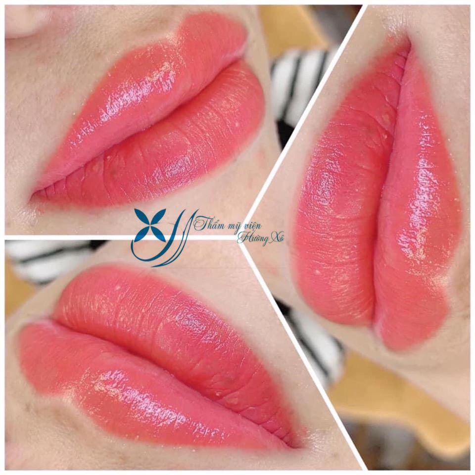 phun môi collagen tại Hà Tĩnh