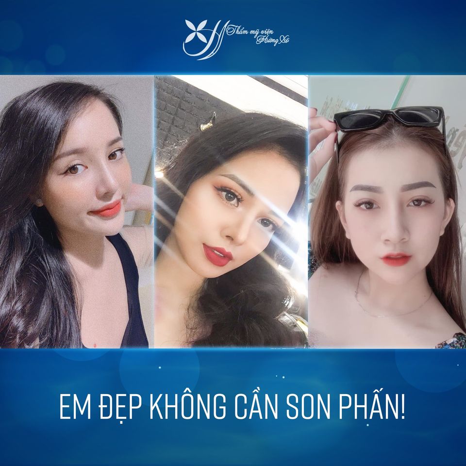 phẫu thuật độn cằm tại nghệ an