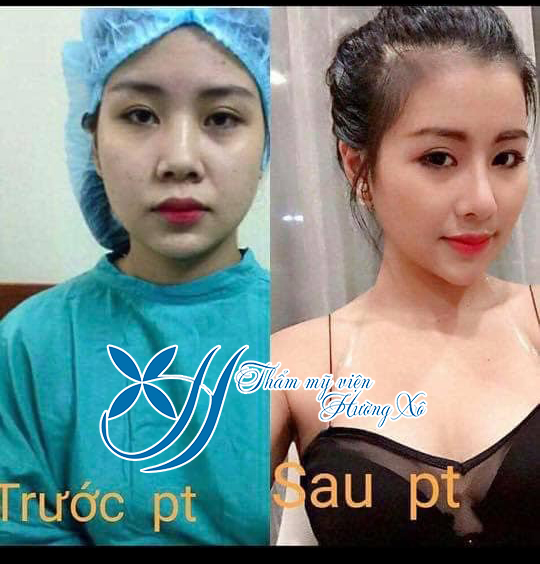 phẫu thuật thẩm mỹ tại Hà Tĩnh