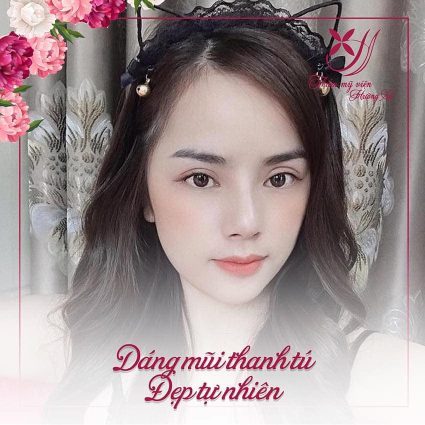 phẫu thuật thẩm mỹ tại Hà Tĩnh