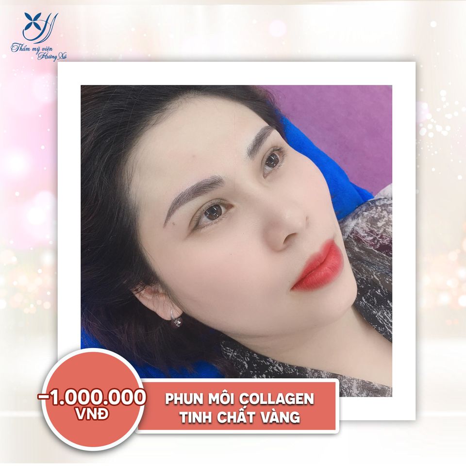 phun môi collagen tại Hà Tĩnh