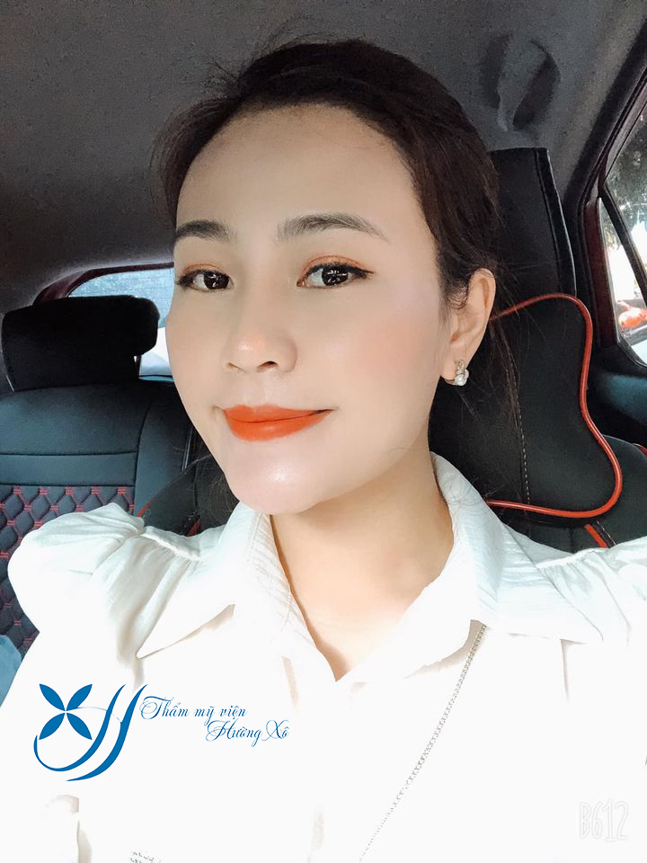 phẫu thuật thái dương tại Vinh