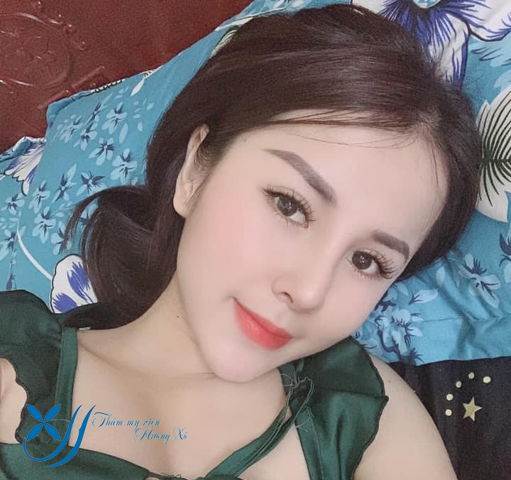 Sửa mũi tại Hà Tĩnh