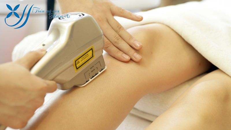 Triệt lông toàn thân tại Hà Tĩnh