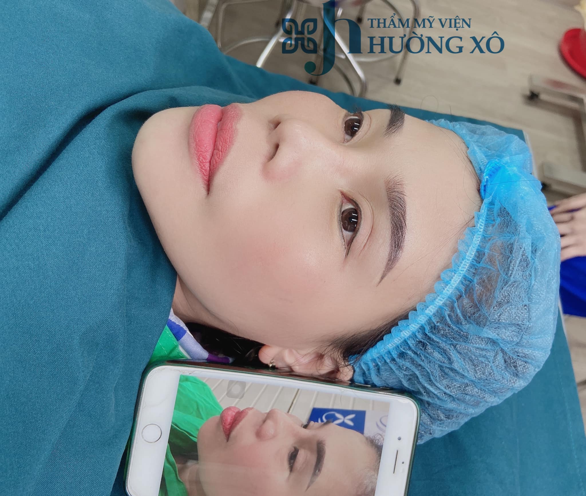 phẫu thuật độn cằm tại nghệ an