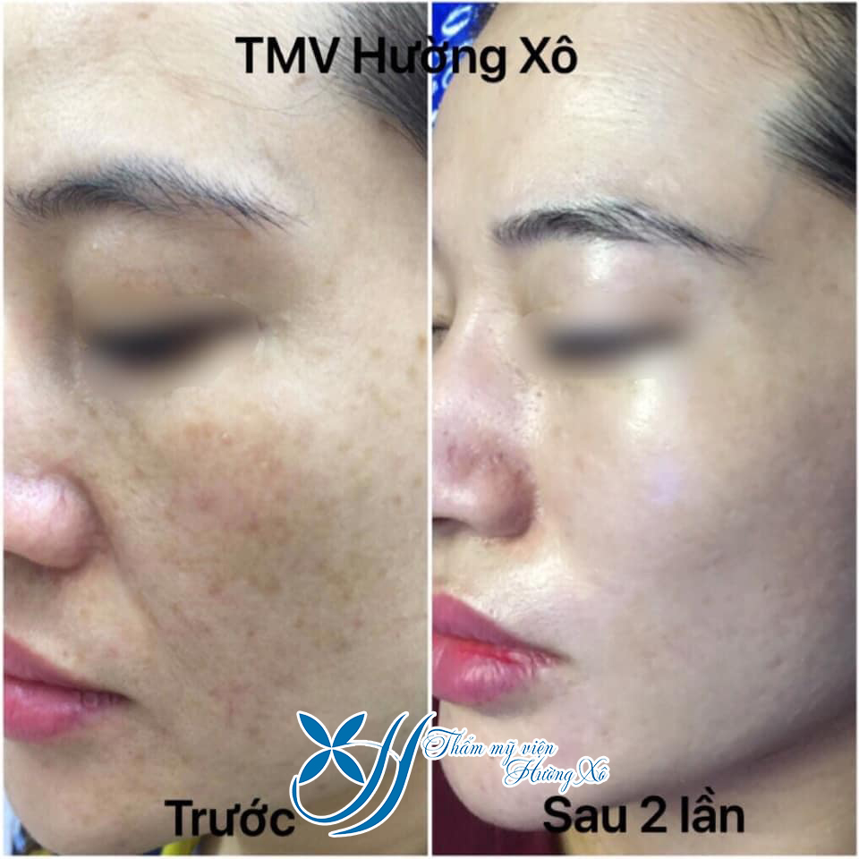 chăm sóc điều trị da tại vinh nghệ an