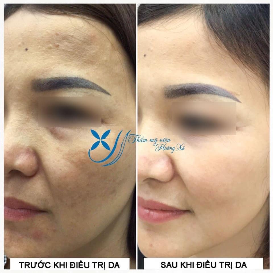 chăm sóc điều trị da tại vinh nghệ an