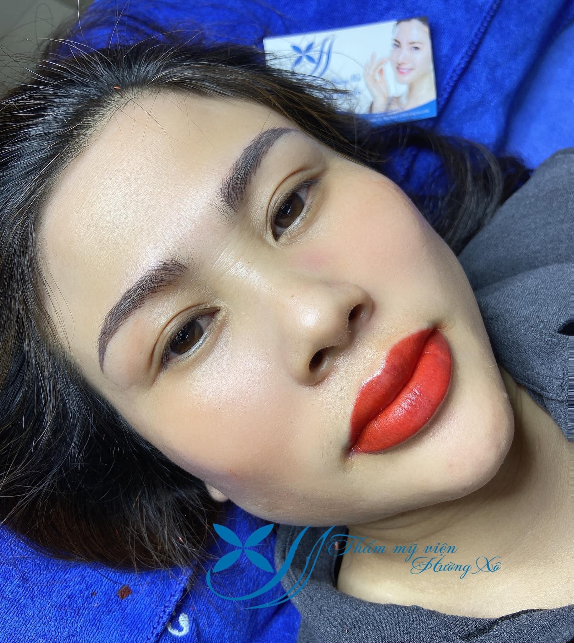 phun môi collagen tại vinh, nghệ an