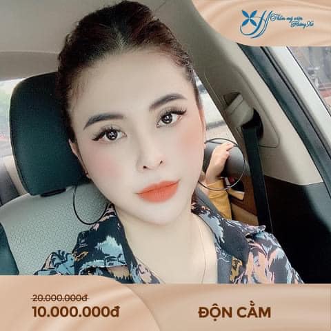 độn cằm tại Vinh, Nghệ An