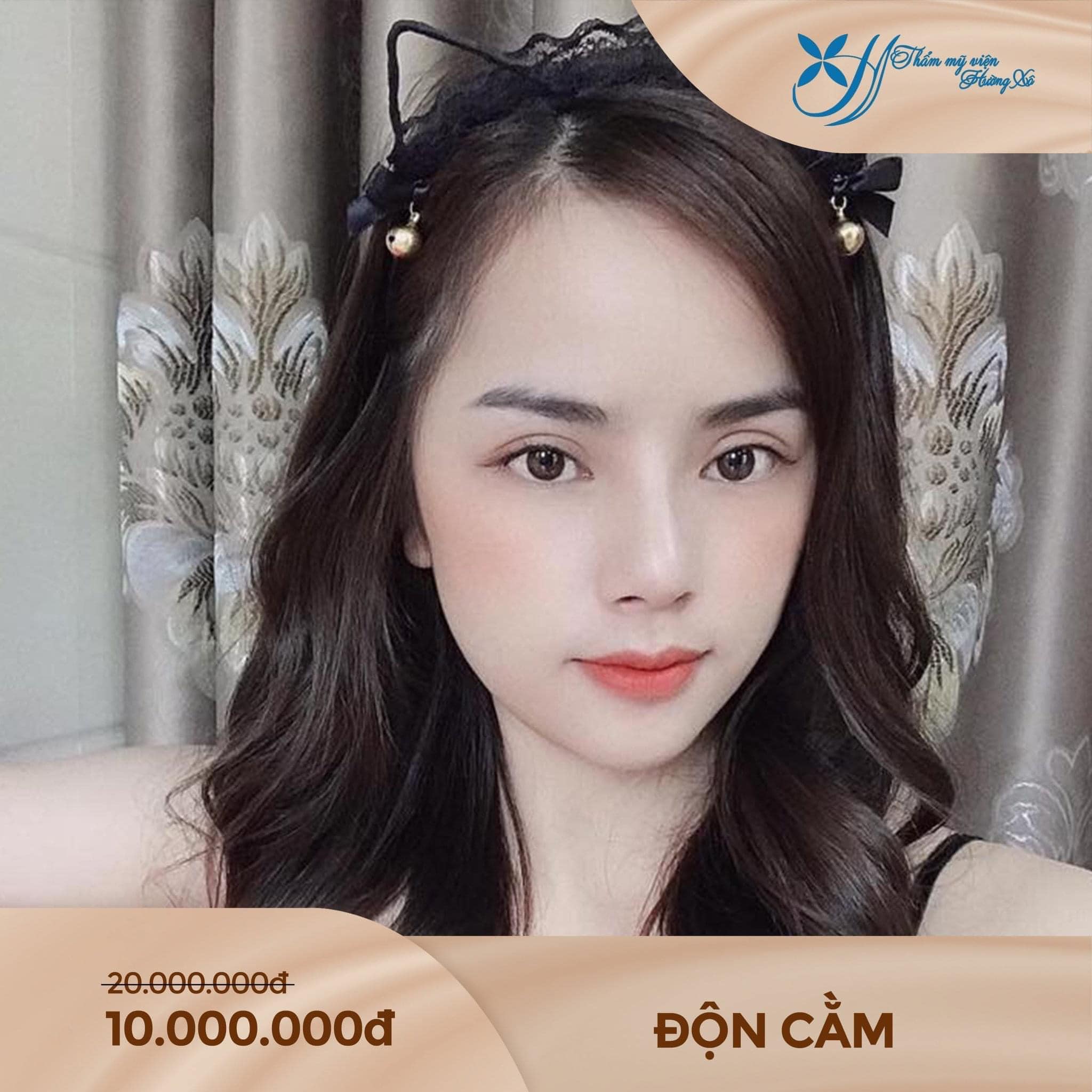 độn cằm tại Vinh, Nghệ An