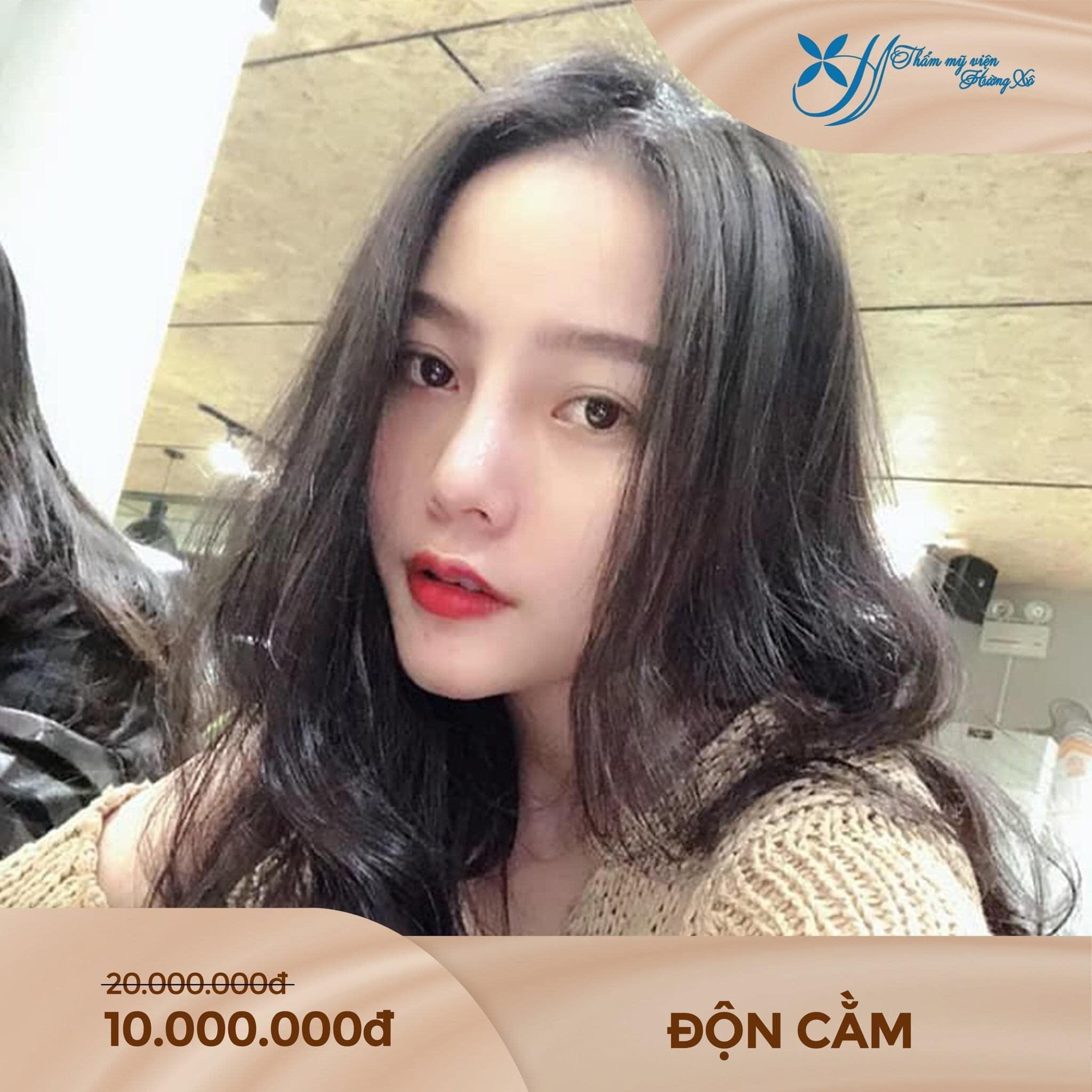 độn cằm tại Vinh, Nghệ An