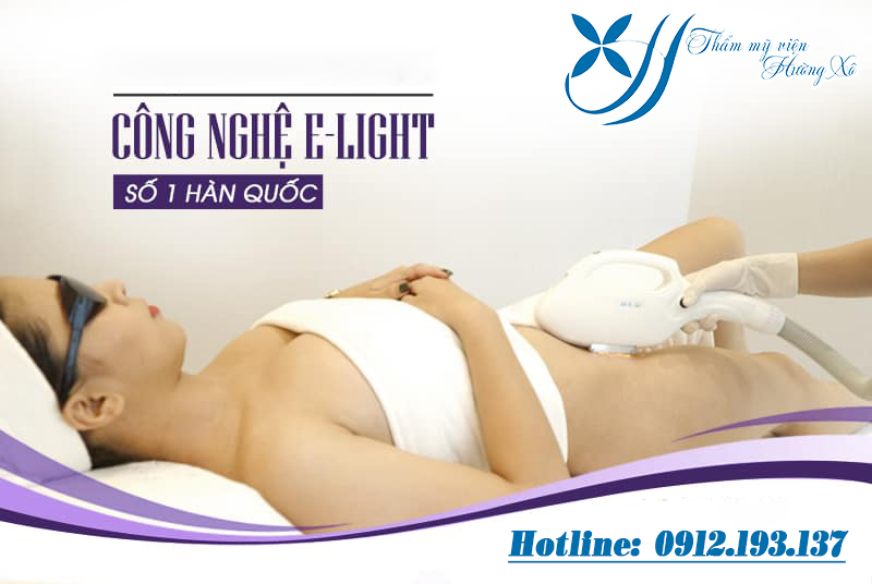 triệt lông toàn thân tại Vinh, Nghệ An