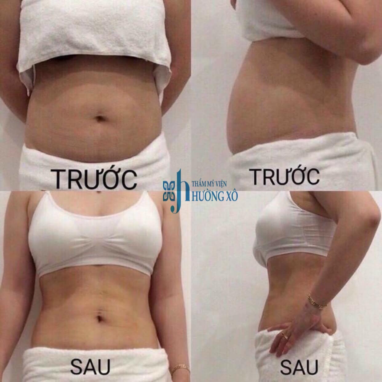 giảm béo sau sinh tại vinh nghệ an